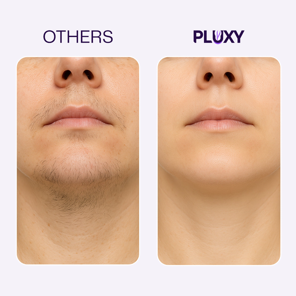 PLUXY - EPIL PRO 3.0